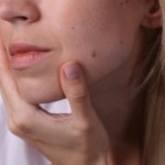 夢占い｜ほくろの夢の意味は？自分の顔や体にほくろができる夢は何を暗示？