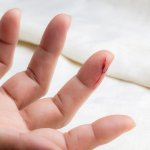 夢占い｜血の夢、血が出る夢の意味は？健康やお金…生命力の象徴